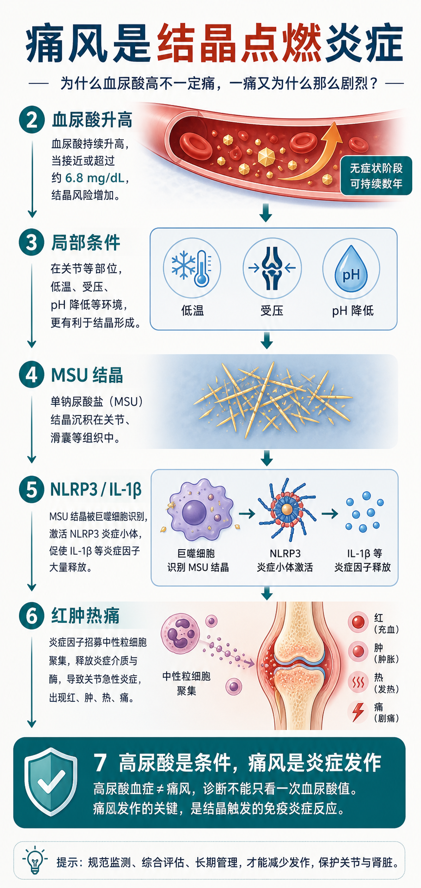 03 尿酸高为什么不一定痛,一痛又为什么那么剧烈?
